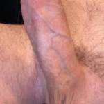 Balls ring hard sack cock hard