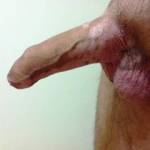 my erected penis