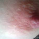Nipple erection