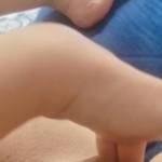 Finger looking good