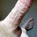 Exposing  my Suckable hard mushroom white cock dick