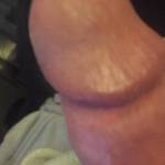 My thick head needs a lick?