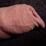 long foreskin