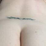 Before I removed my tattoo
