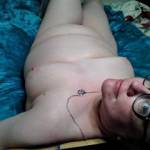 Photos after anal.