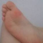 feet soles