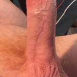 Hard and glistening