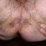 the first pic of my hairy butt what do you think?