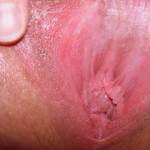 just waiting around for a tongue or cock