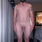 Took a pic. After my surgery. How does it look??
