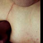 Much bigger dildo. Difficult at first but then I tried again and got it in. Sorry for the lousy camera angle, I was horny and determined to get the dildo in. I'll redo this with a much better angle once my hole recovers.