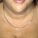 Tits