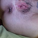 Pick a hole , anyhole !!!