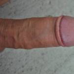 foreskin pulled back