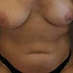 Just another of my breasts.