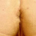 My girl without panties bum cheeks & bumhole  full of collagen so so soft kissing her bum hole  is like kissing her soft lips