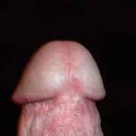 just the tip