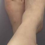 It all starts with the feet….