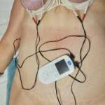 Using the tens unit on her bound udders