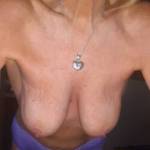 My 70 yr old Granny titties