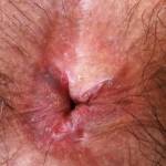 Want to cum in my volcano?