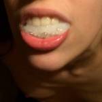 Another nice view of a mouthful