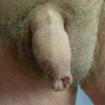 small dick with long 4skin in a hairy bush