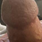 Mushroom tip