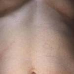 Under boob view