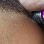 Both holes filled