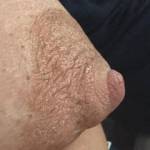 Wife’s puffy nipple