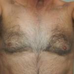 Not every woman likes a hairy chest, especially when it is turning white down the middle. Any teddy bear lovers out there?