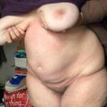 4 of 4 - right nipple side view