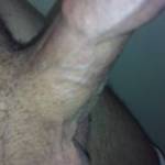 Dick