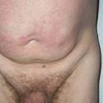 big belly   small cock