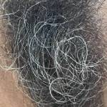 Hairy still