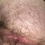 Spreading and exposing my hairy furry hole