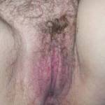 hairy wet minge