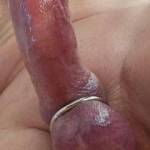 Squeeze oxballs ball stretched