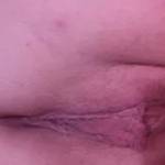 doesn't it look like it needs to be folled