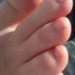 toes