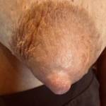 The whole Areola became puffy
