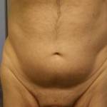 Just a body shot for you