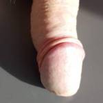 Cockhead with foreskin skinned back.