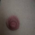 Nippellein