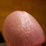 cockhead