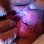 a bit of gaping