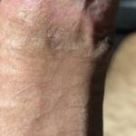Needs sucked
