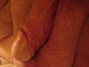 Here's a pic of my big uncut cock and balls, with the head exposed.