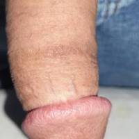 Dick pic